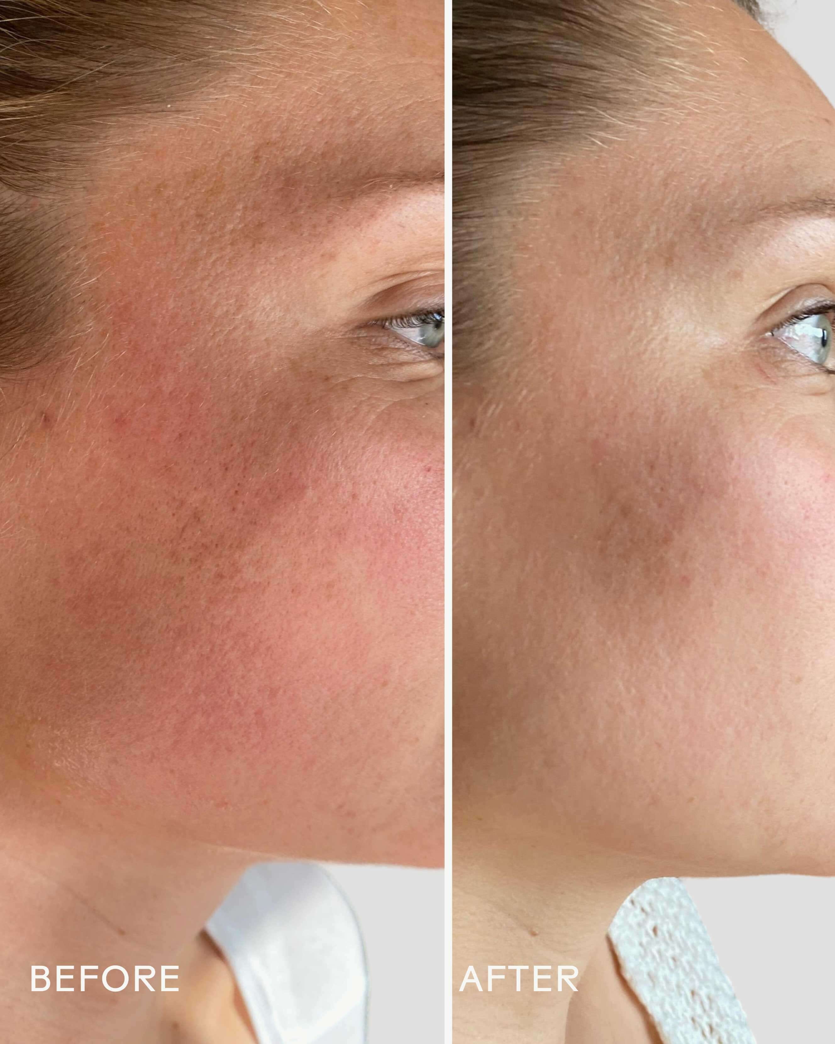 Three Ships SkinHero™ Bakuchiol + Calendula Bio - Retinol Serum