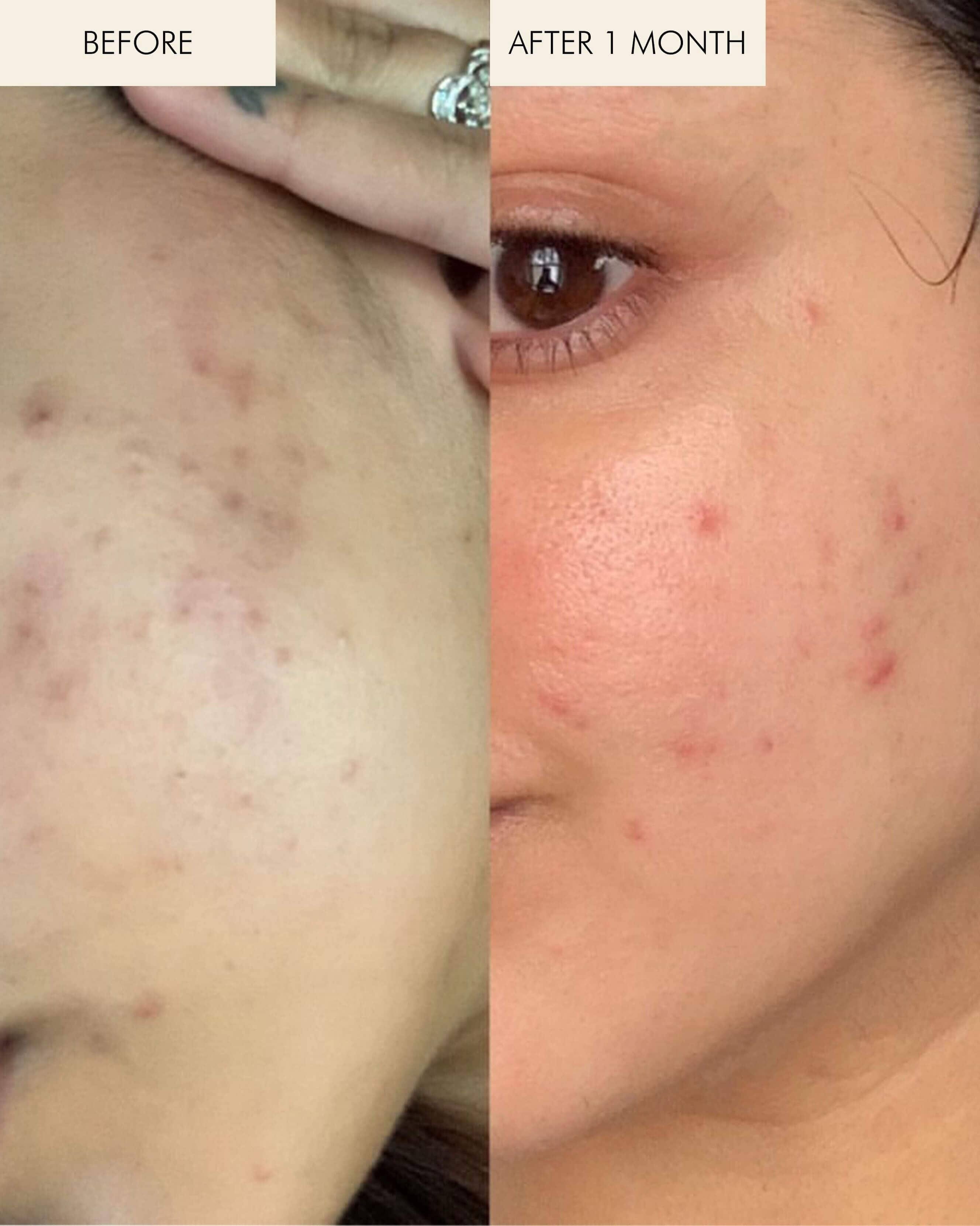 MARA Sea Vitamin C Serum for Brightening Dark Spots & Redness with Algae