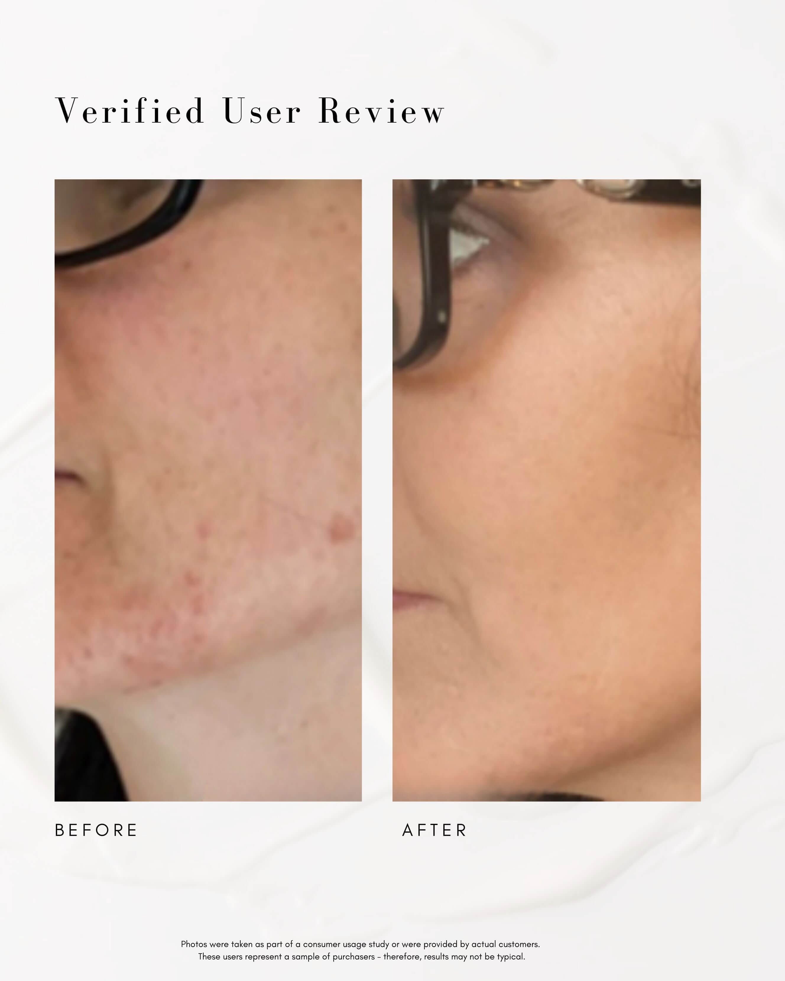 Maya Chia The Straight A Advanced Gentle Retinol Serum