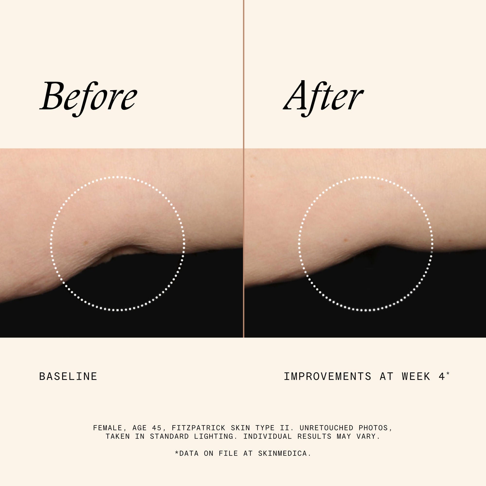 Skinmedica Firm & Tone Lotion for Body