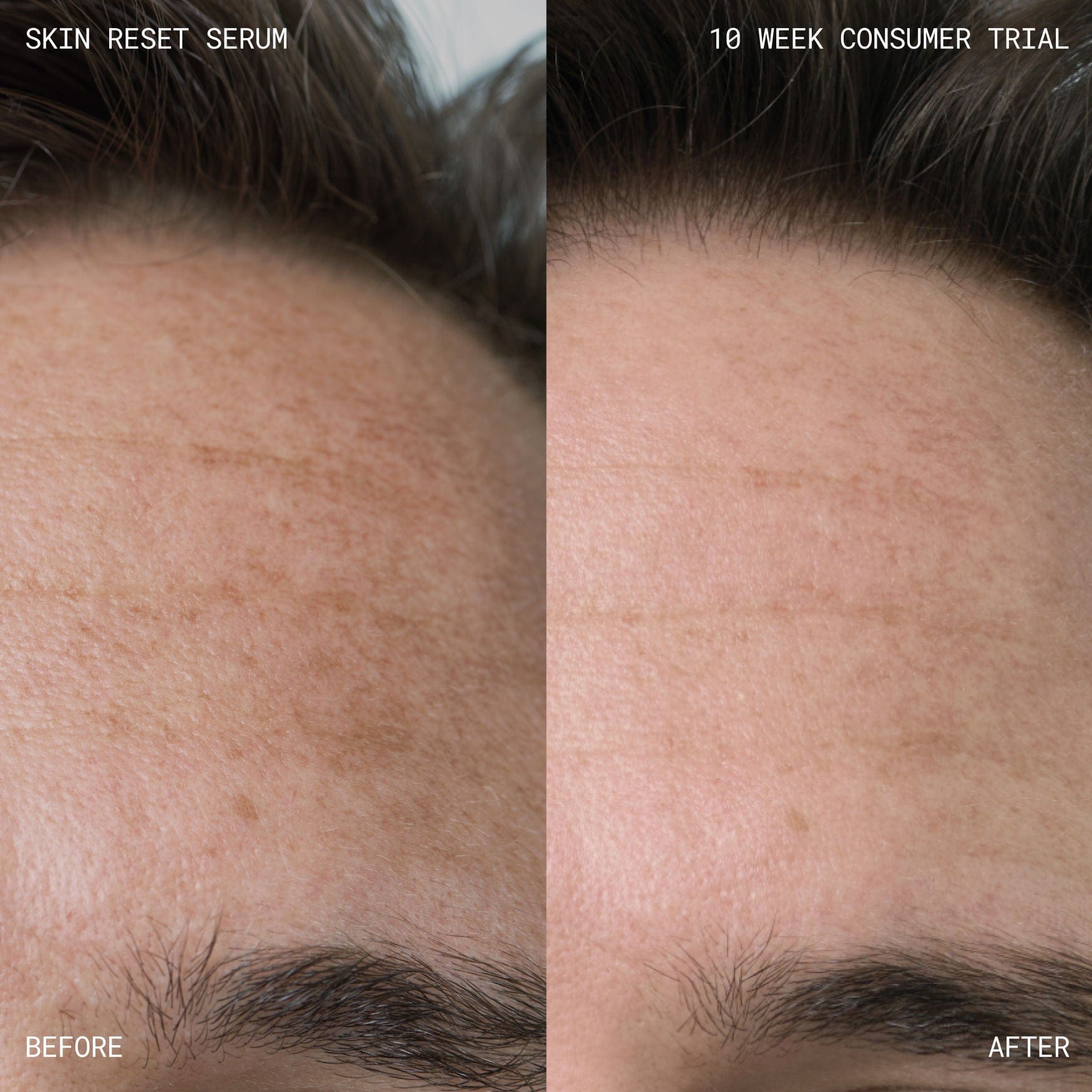 Emma Lewisham Skin Reset Face Serum