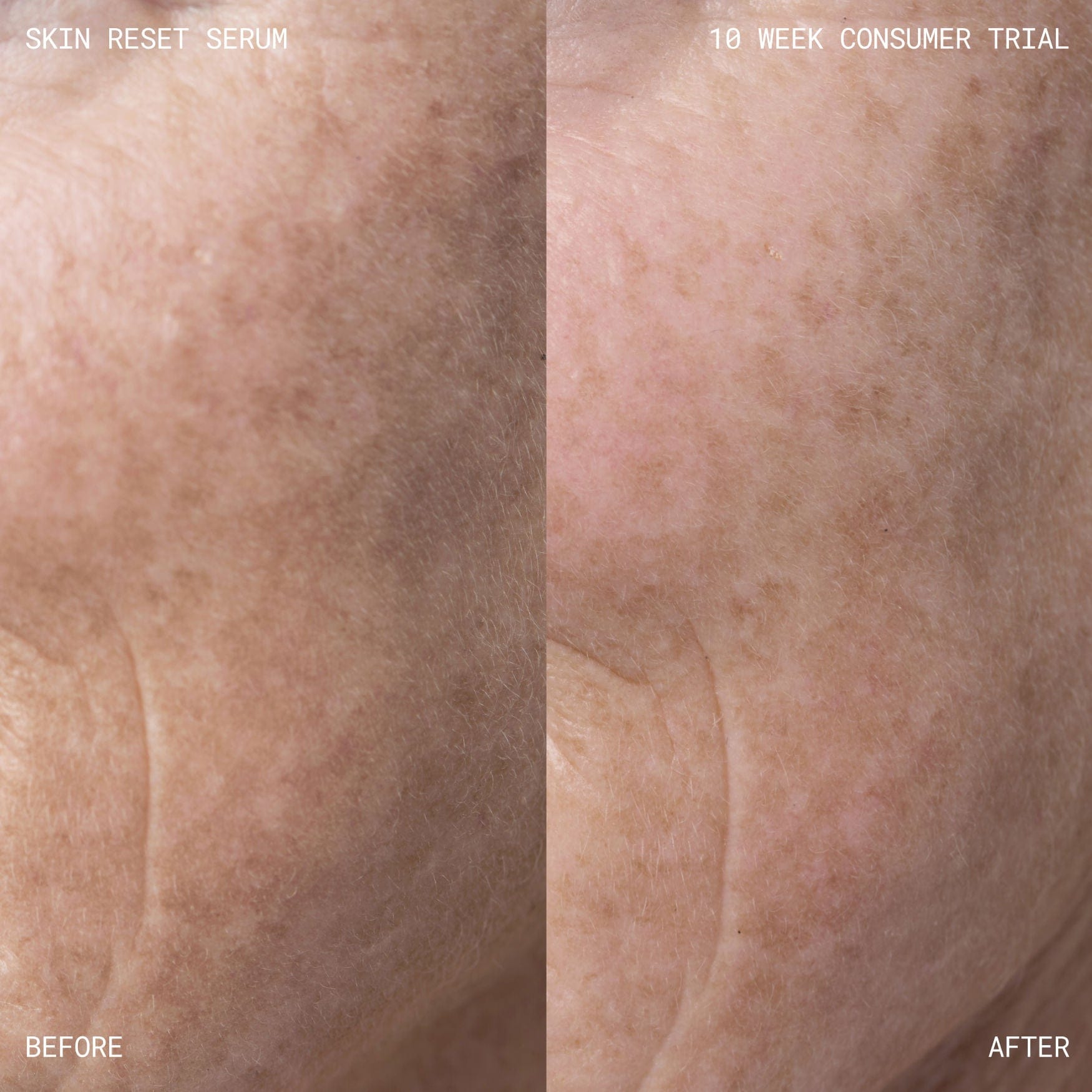 Emma Lewisham Skin Reset Face Serum