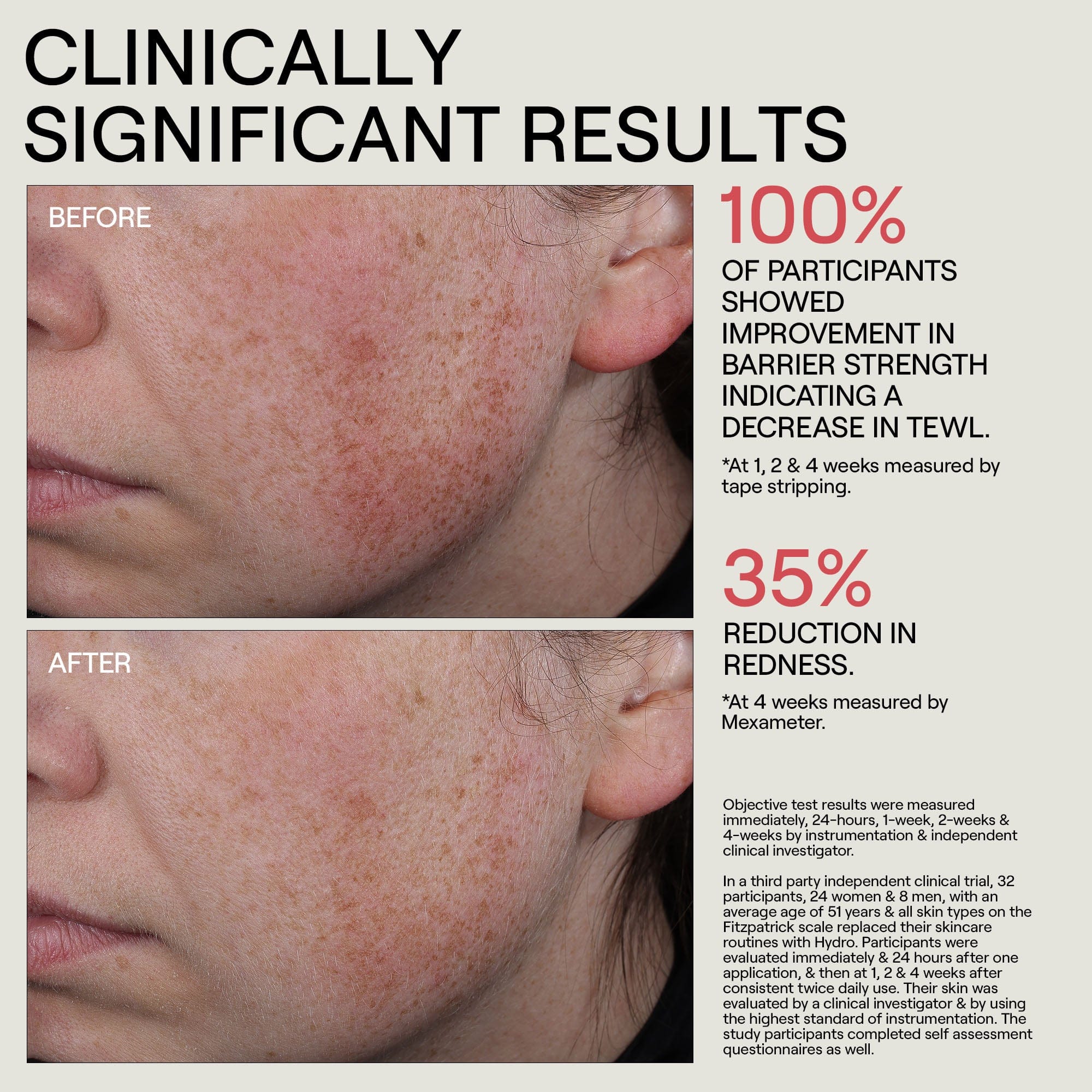 Dr. Diamond’s Metacine HYDR/O Bioactive Hydrolipid Barrier Moisturizer