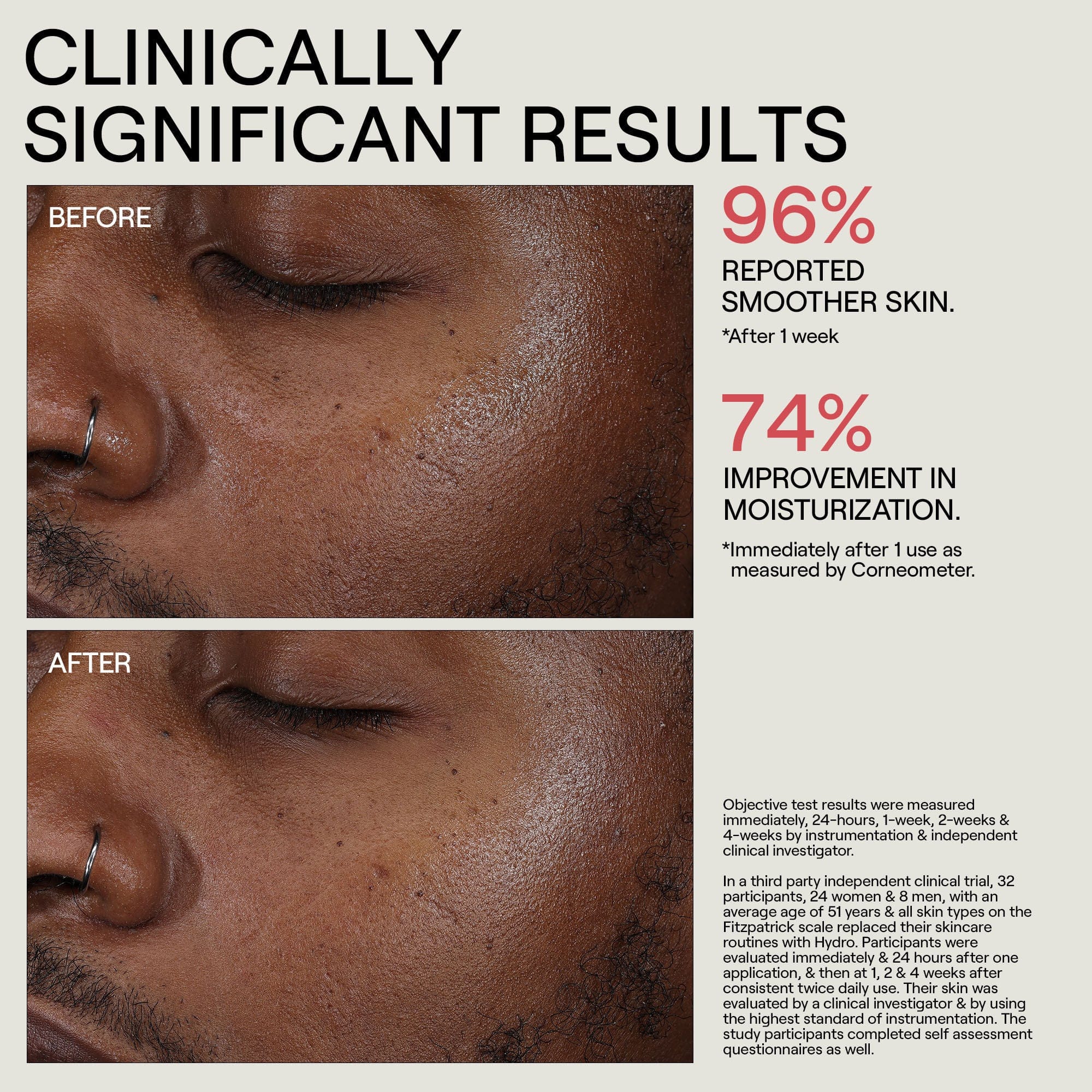 Dr. Diamond’s Metacine HYDR/O Bioactive Hydrolipid Barrier Moisturizer
