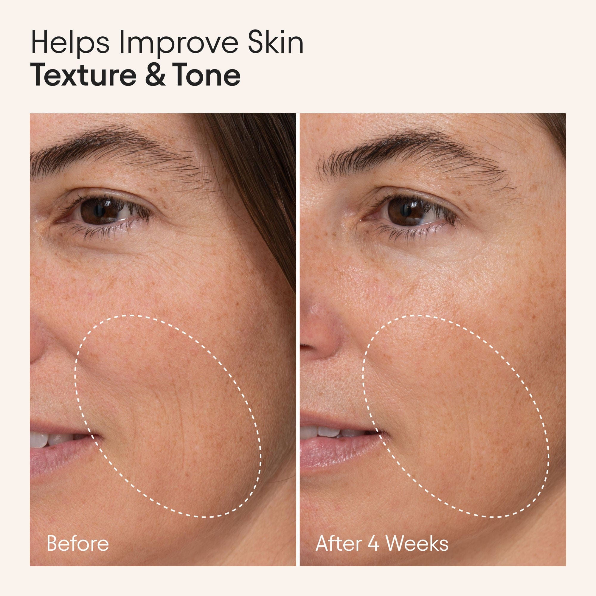 Alpyn Beauty Hydrating Firming Serum with Niacinamide and Nettle