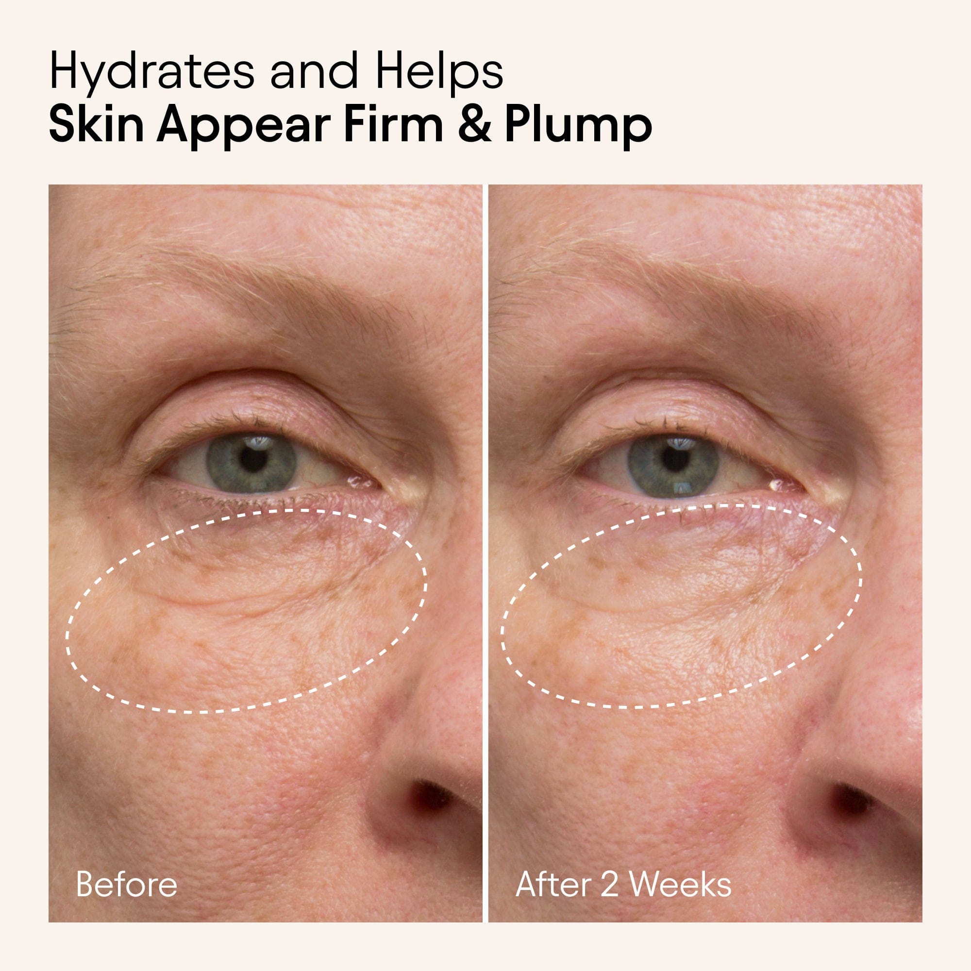 Alpyn Beauty Hydrating Firming Serum with Niacinamide and Nettle