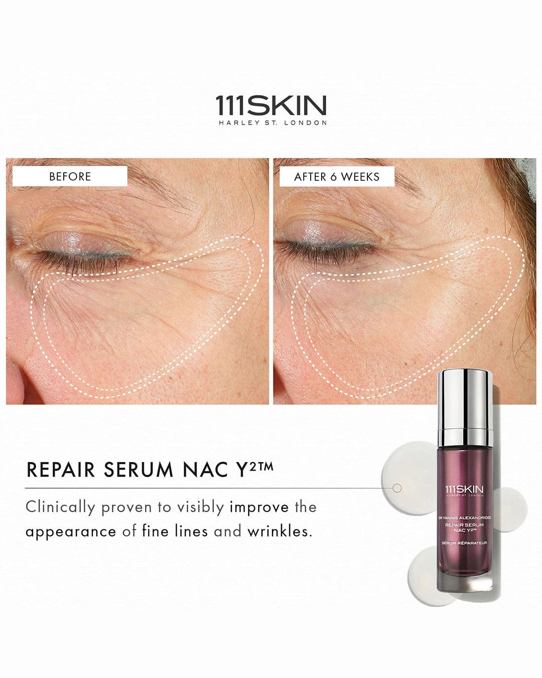 111skin Repair Serum Nac Y²™