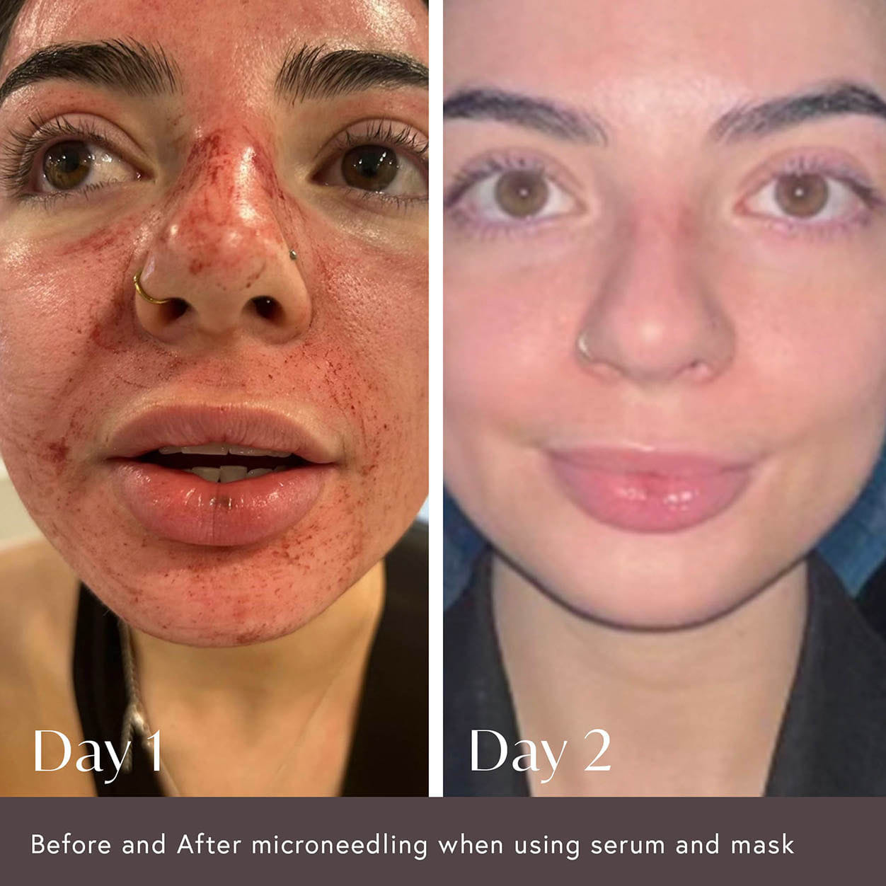 Viktor Michael Hidden Agenda Pre and Post Injection Care Serum