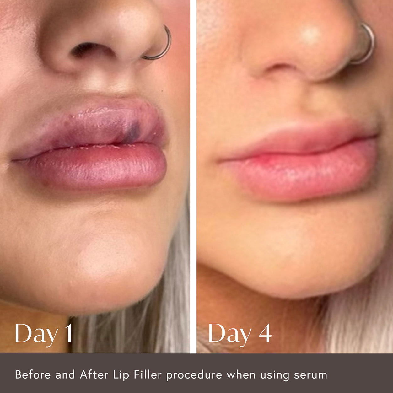 Viktor Michael Hidden Agenda Pre and Post Injection Care Serum