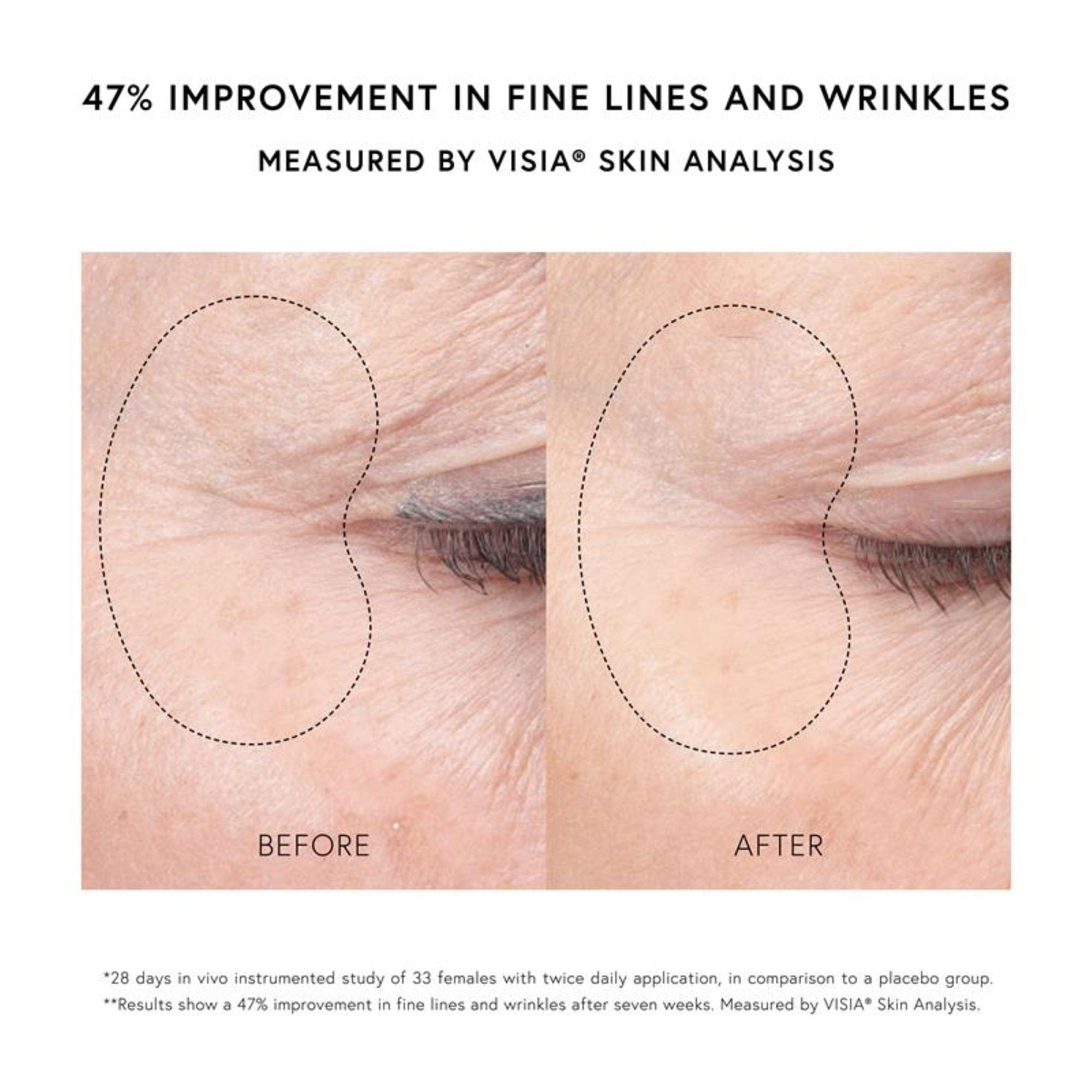 Dr. Barbara Sturm Super Anti - Aging Eye Serum