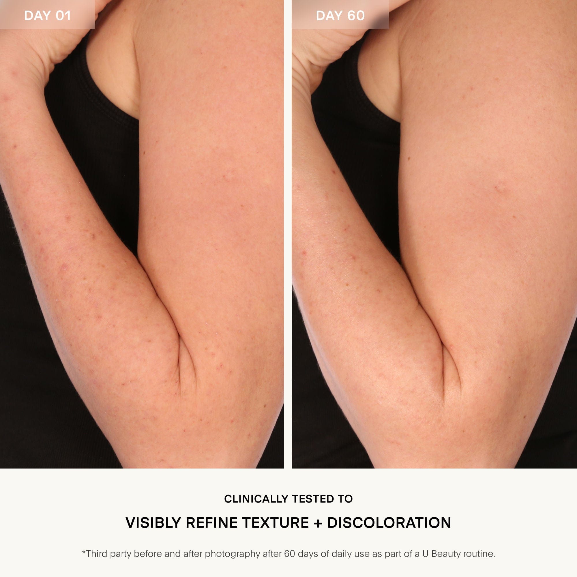 U Beauty Resurfacing Body Compound