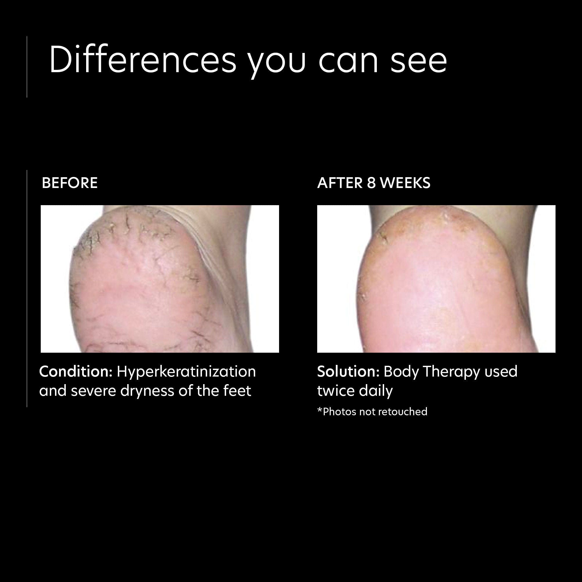 PCA Skin Body Therapy