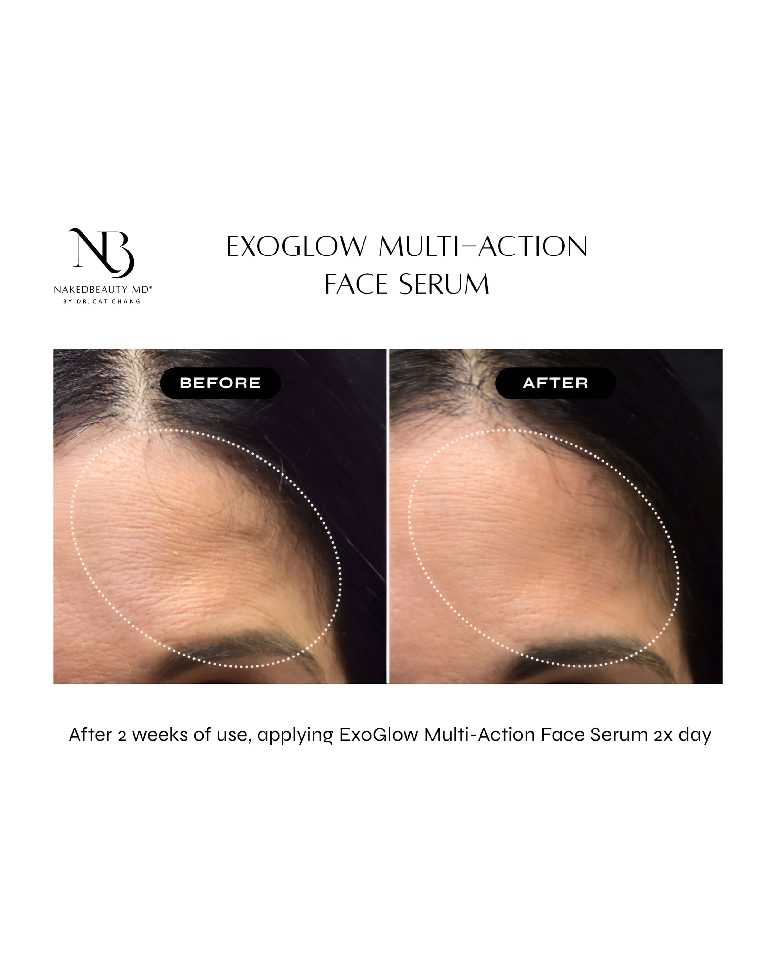 Nakedbeauty MD Exoglow Multi - Action Face Serum