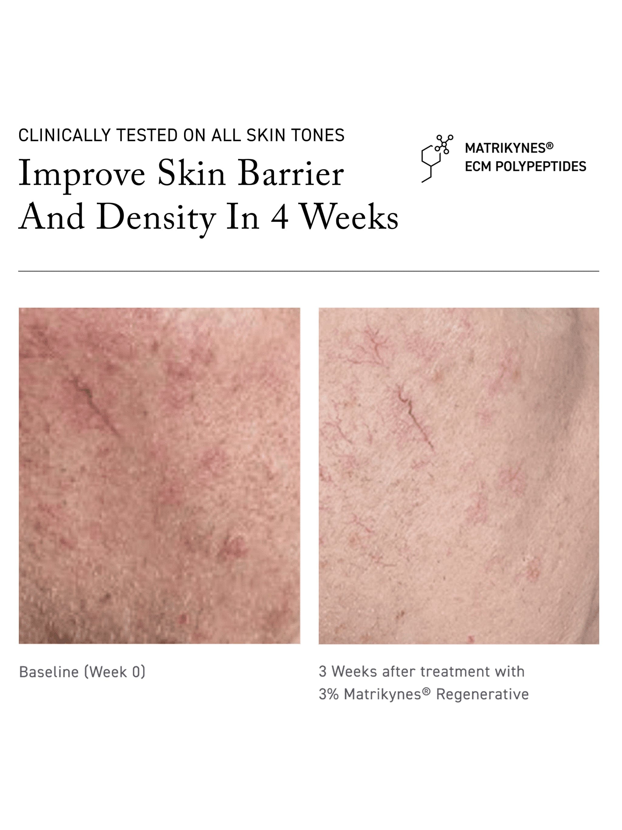 Sweet Chemistry Barrier Repairing Hydra - Serum