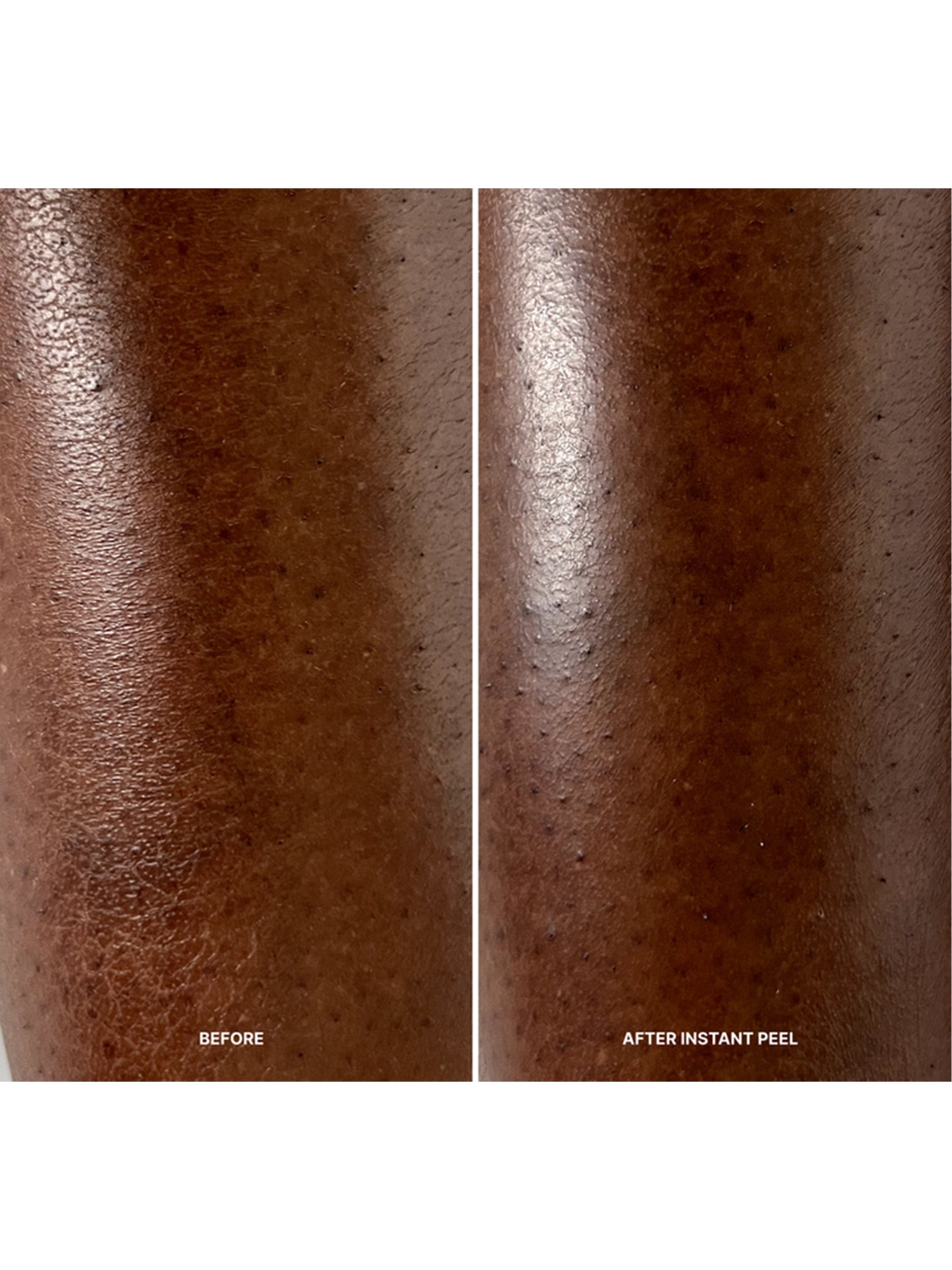 Lilis Instant Peel