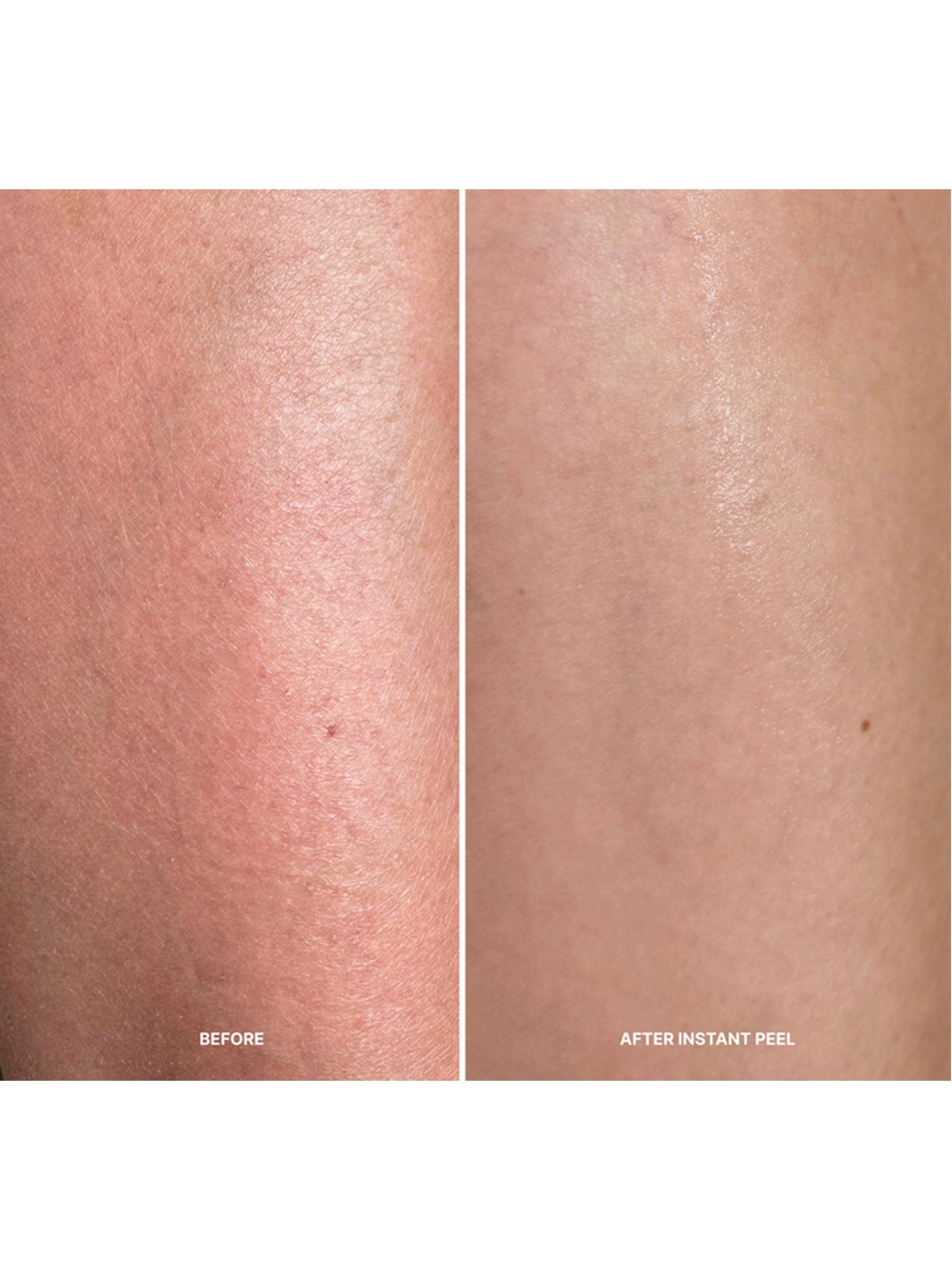 Lilis Instant Peel