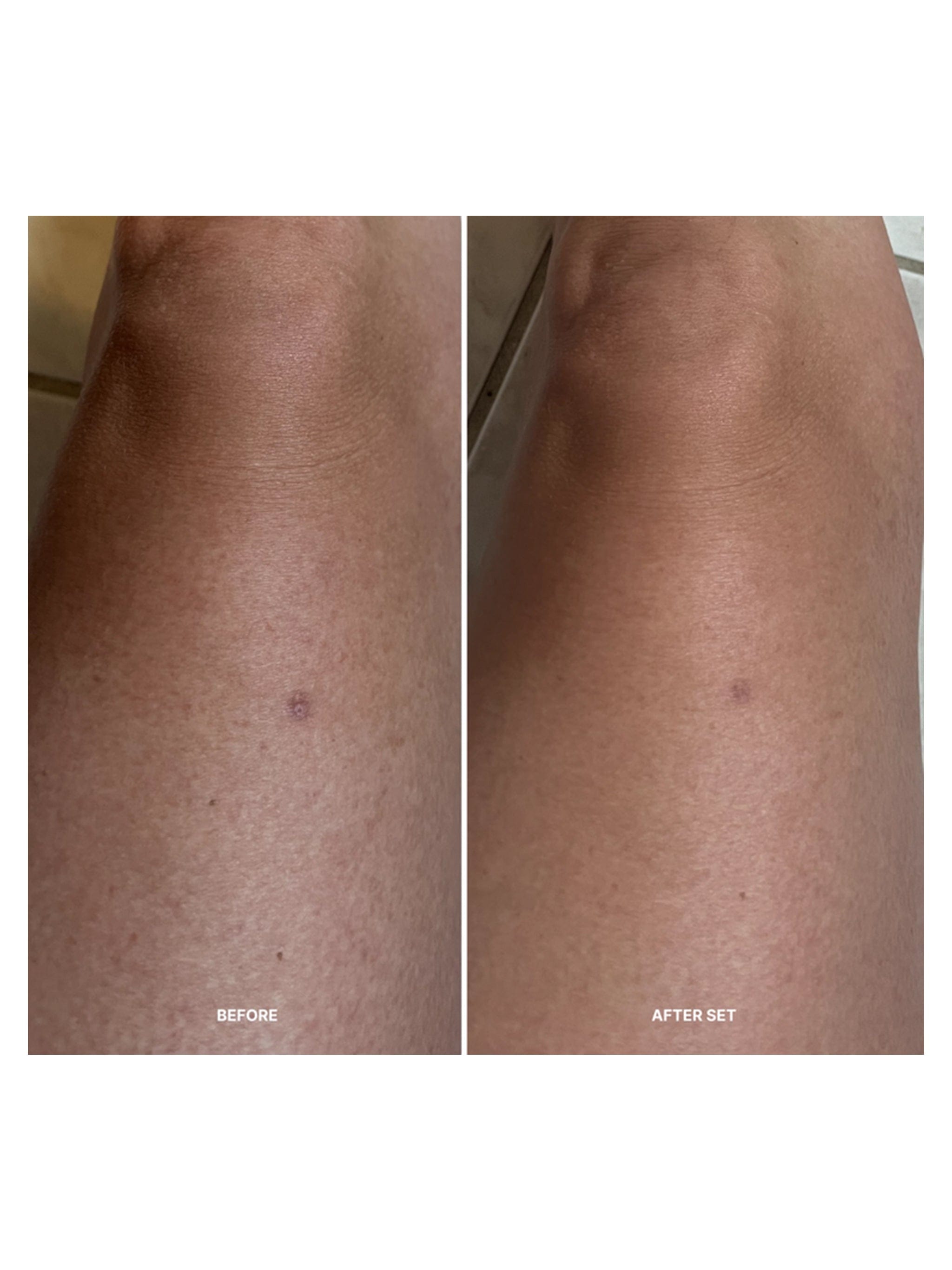Lilis Korean Body Resurfacing™ Set