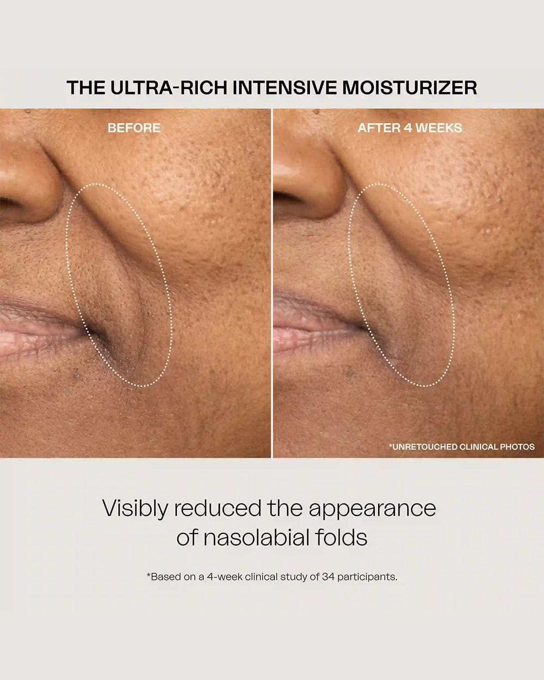 Eighth DAY The Ultra Rich Intensive Moisturizer
