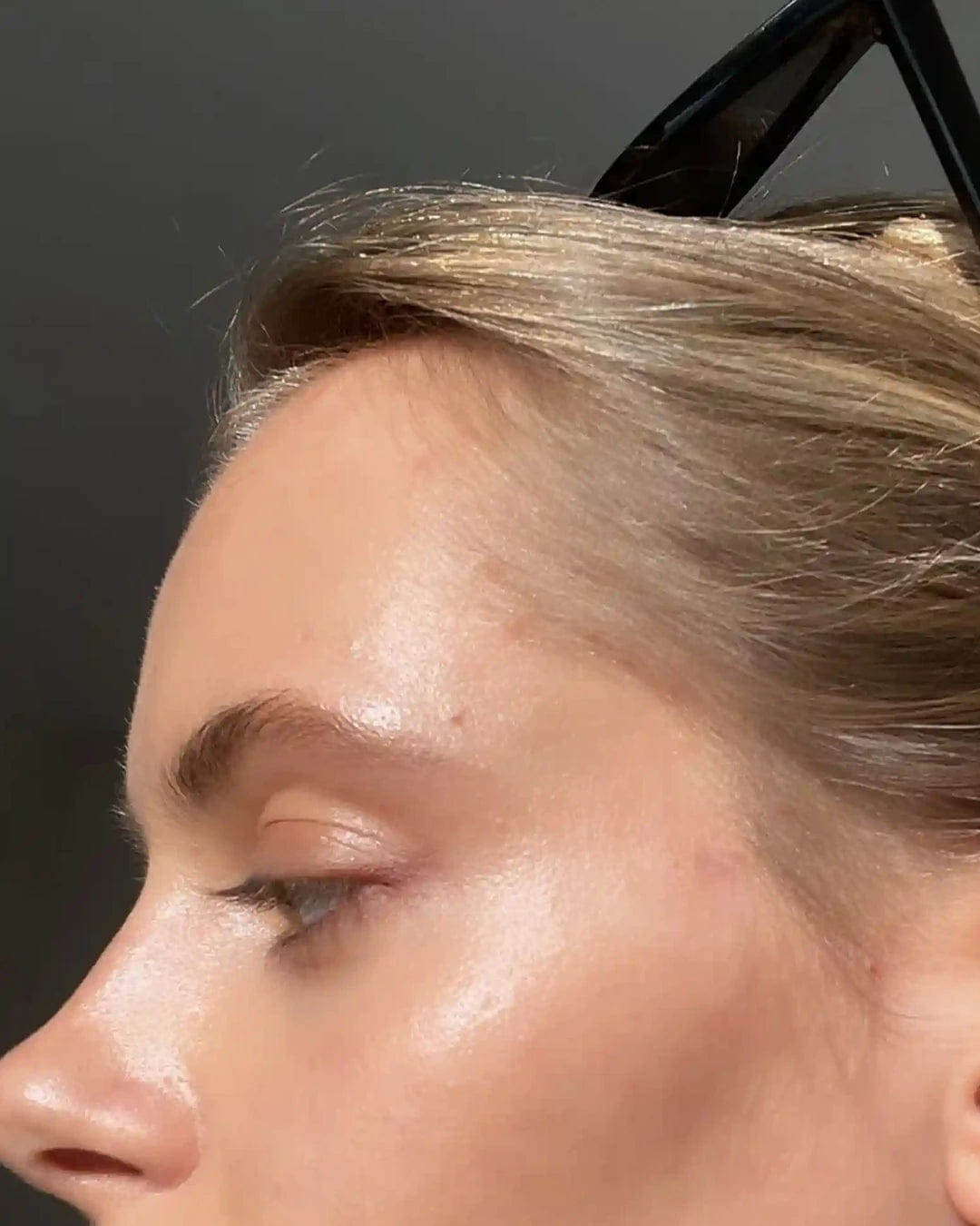 Tronque Scar Concentrate
