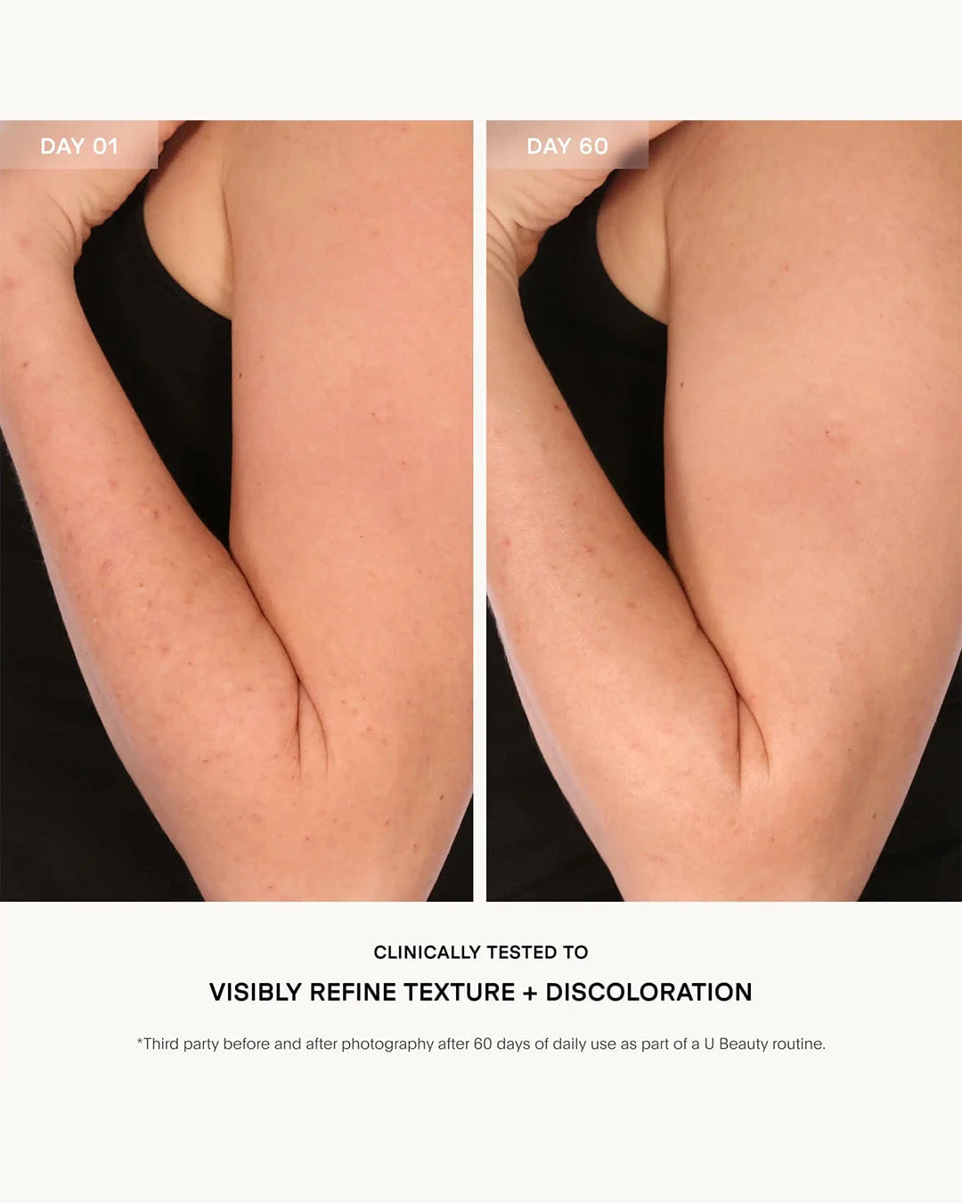 Ubeauty The Resurfacing Body Compound