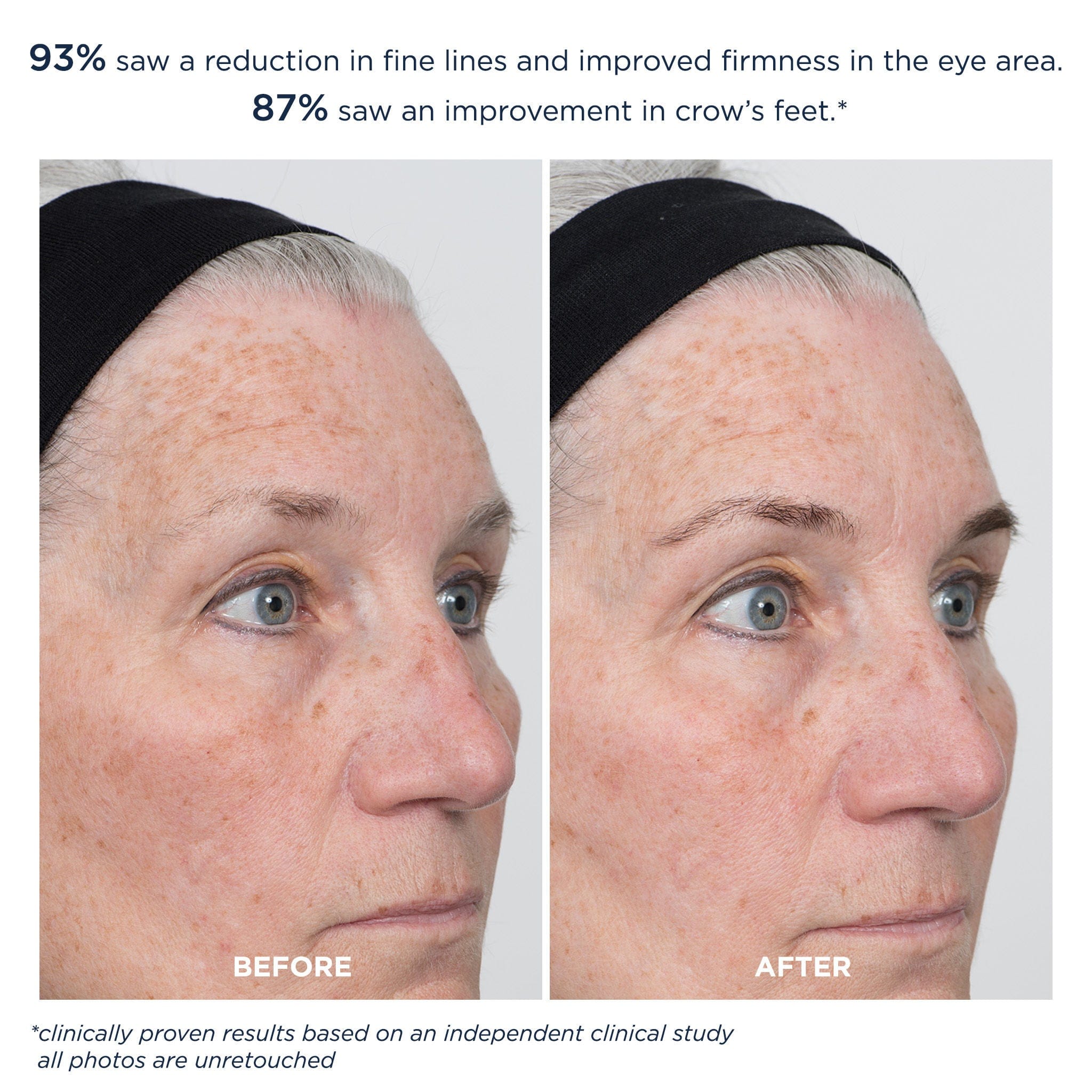 M-61 ProSmooth Retinol Eye Serum