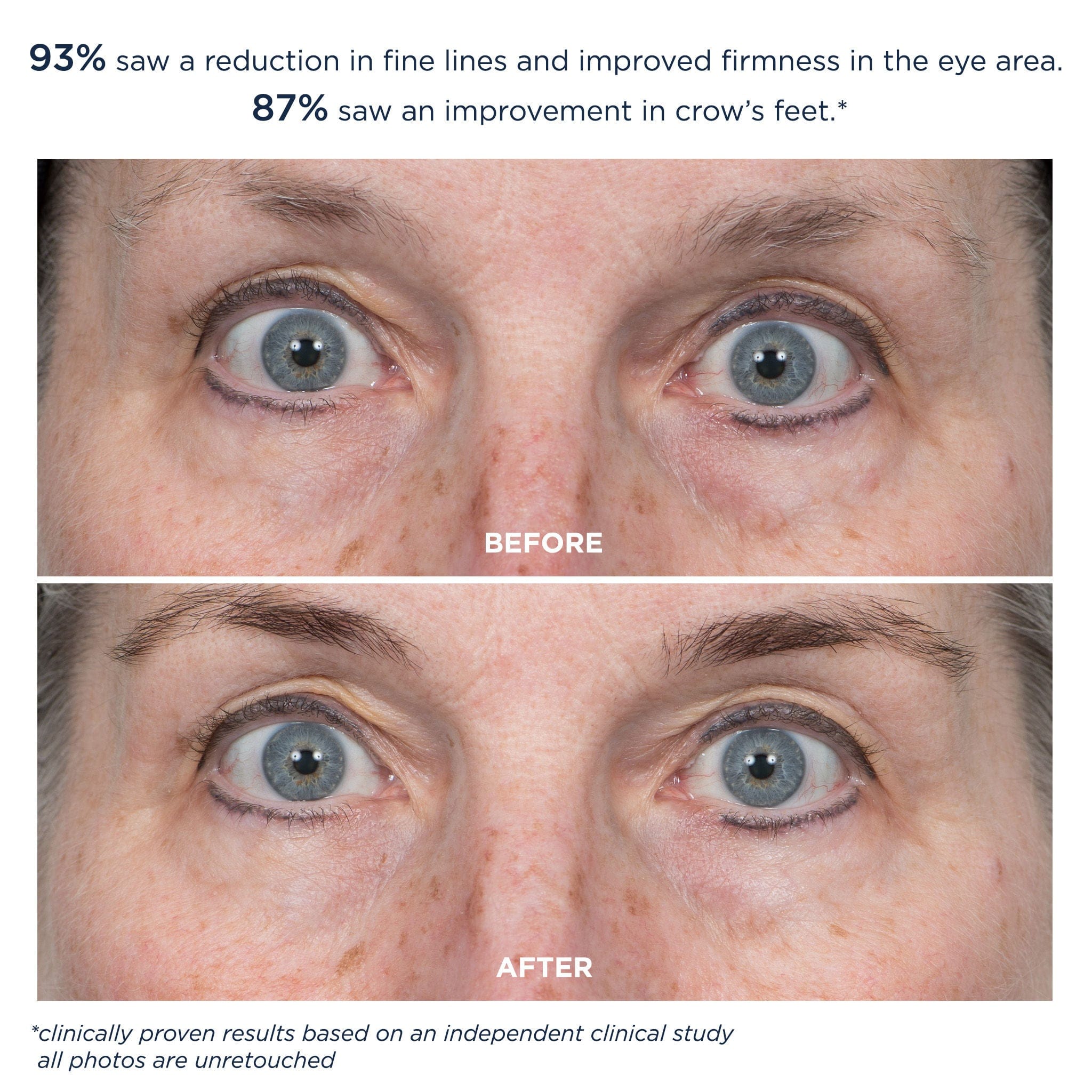 M-61 ProSmooth Retinol Eye Serum