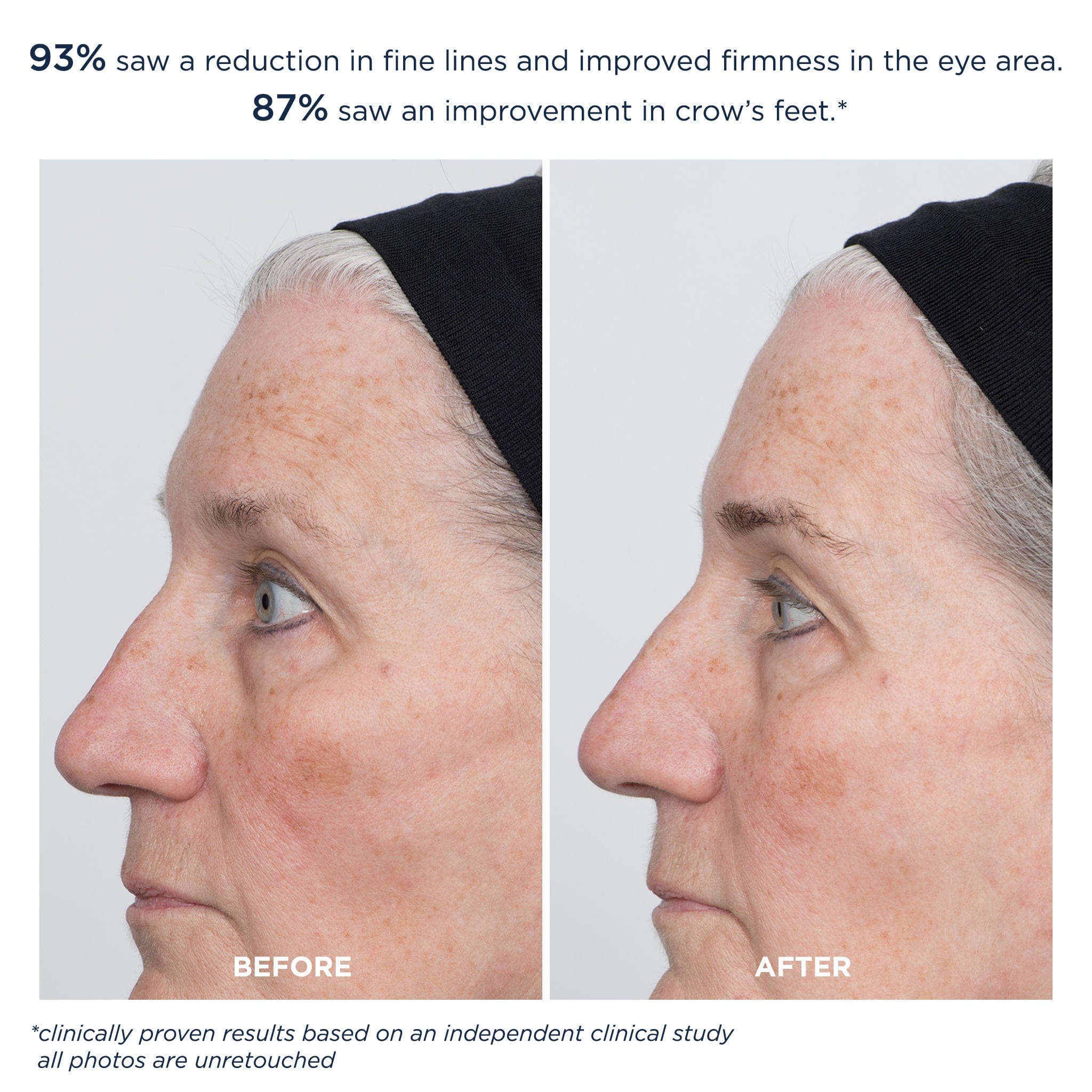 M-61 ProSmooth Retinol Eye Serum