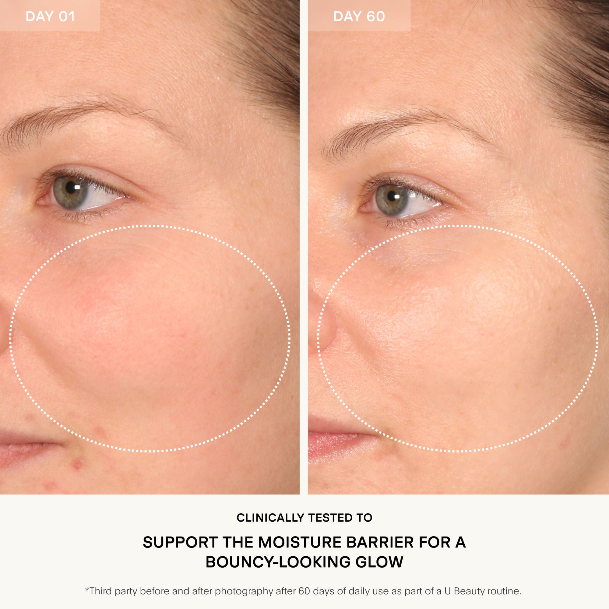 U Beauty The Barrier Bioactive Treatment