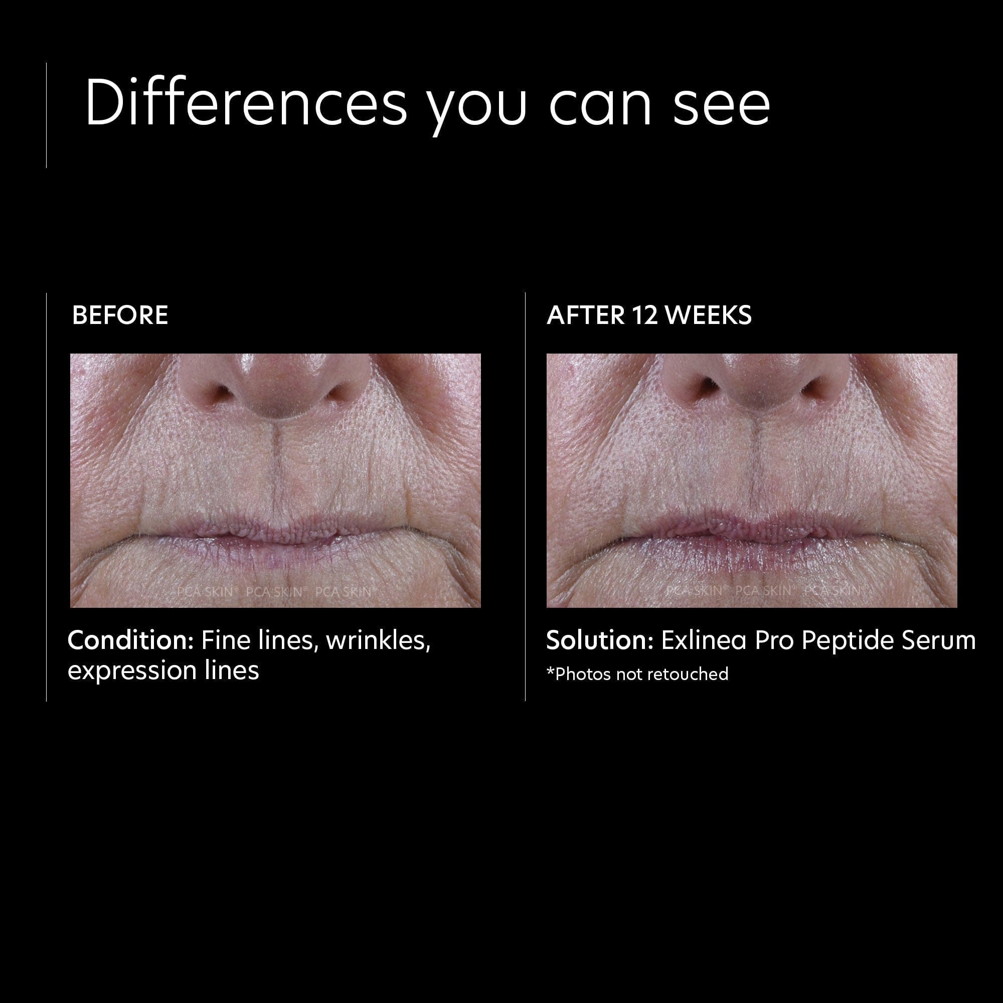PCA Skin ExLinea Pro Peptide Serum