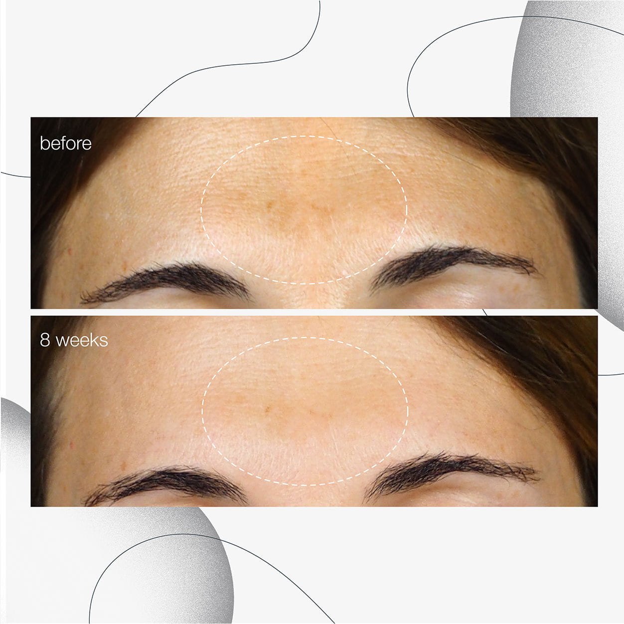 Dermalogica PowerBright Dark Spot Serum