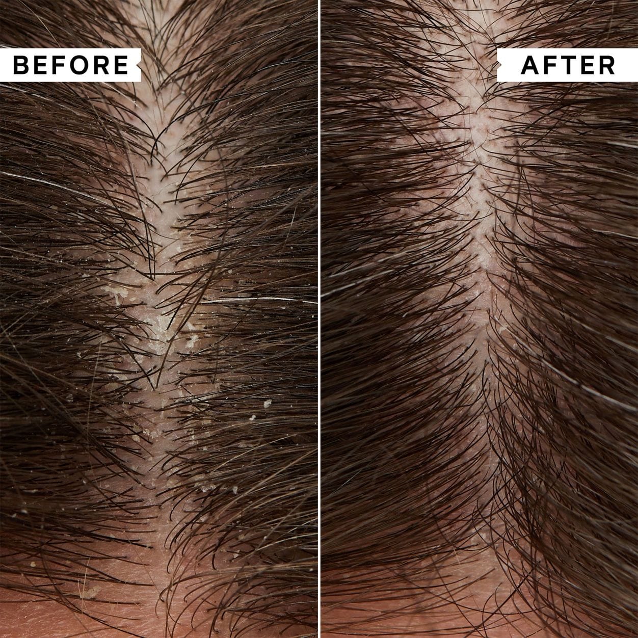 Philip Kingsley Flaky Scalp Hydrating Conditioner
