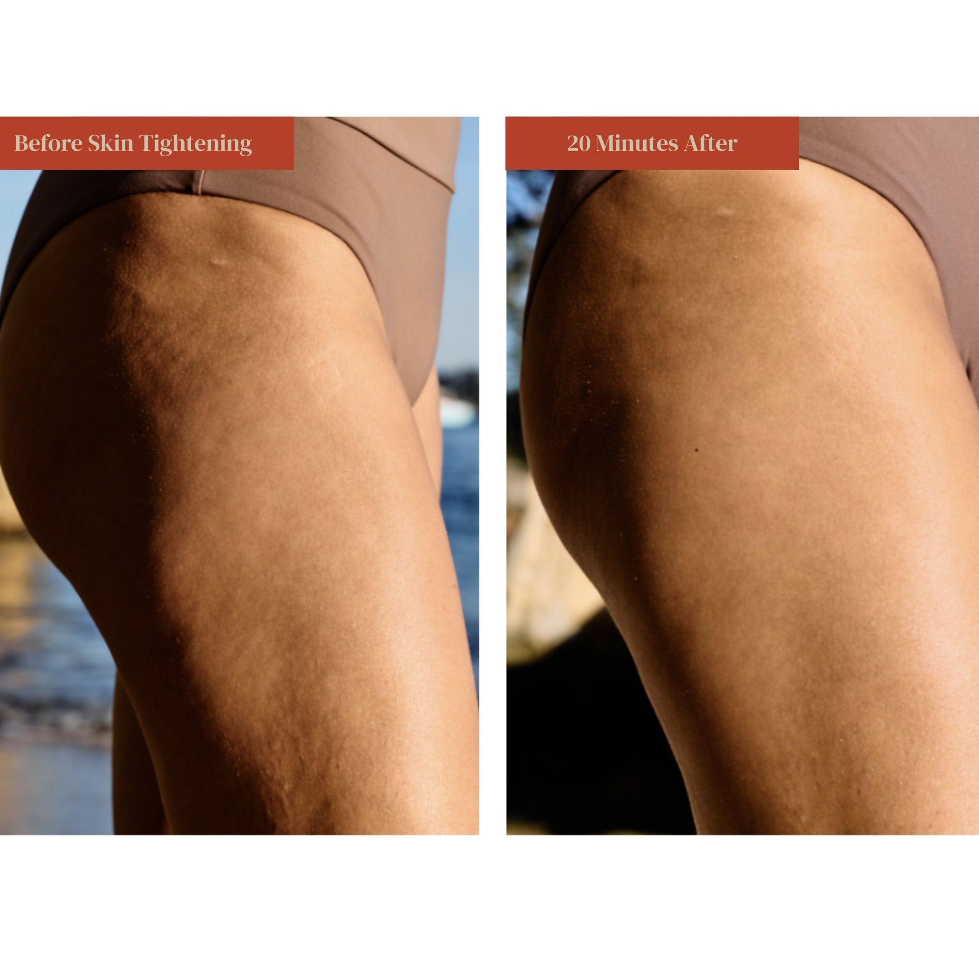 Dr. Few Skin Tightening + SPF 30
