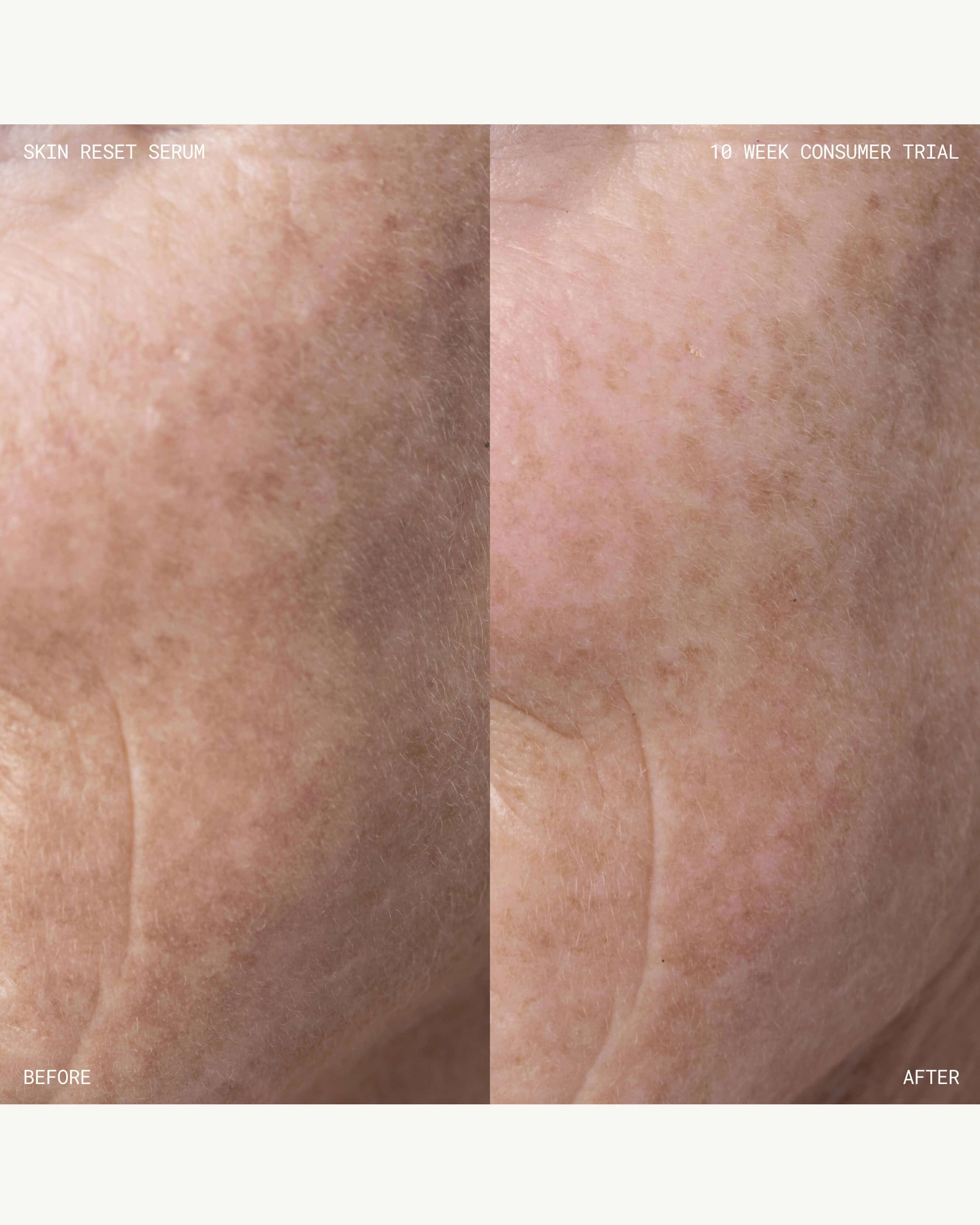 Emma Lewisham Skin Reset Serum