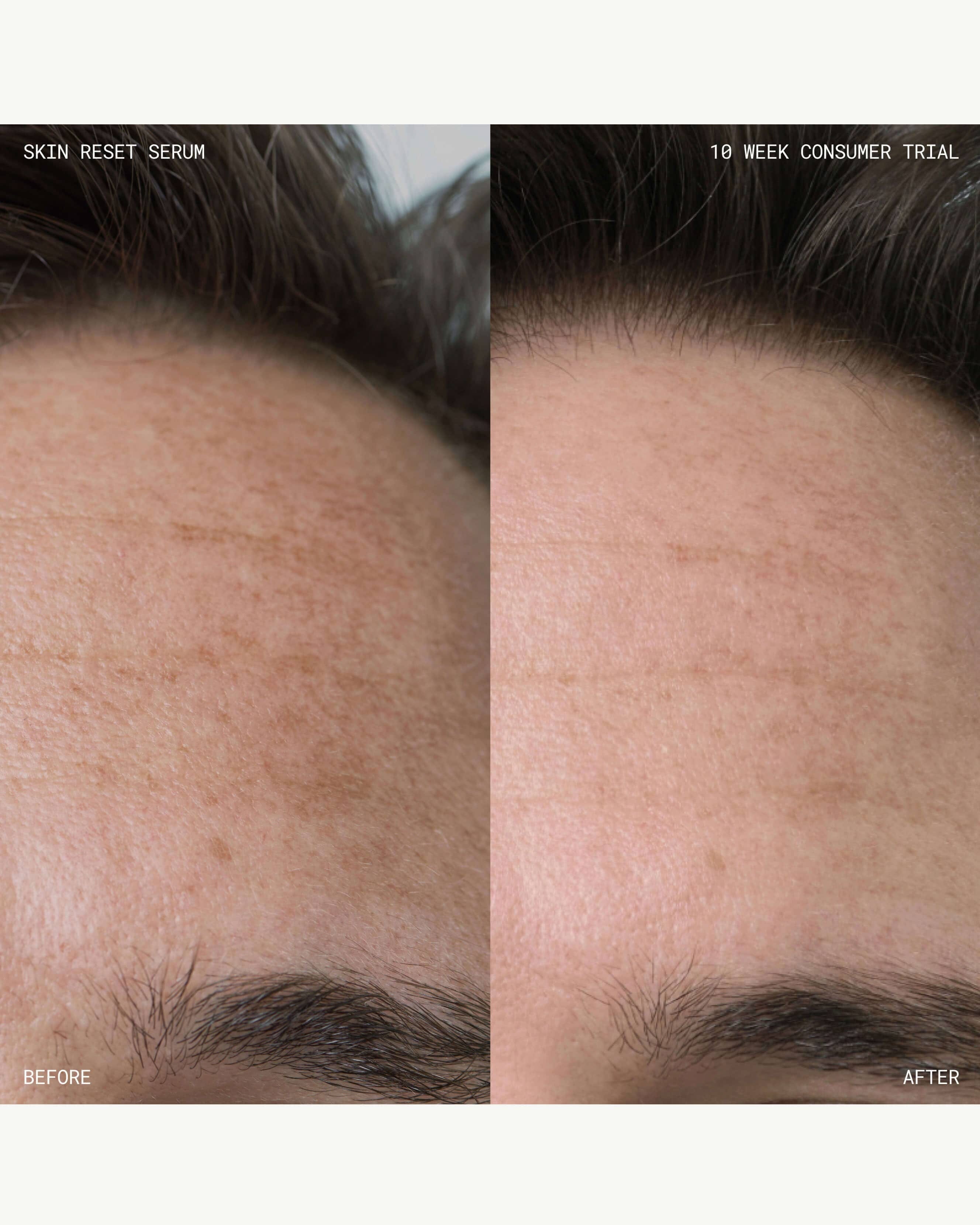 Emma Lewisham Skin Reset Serum