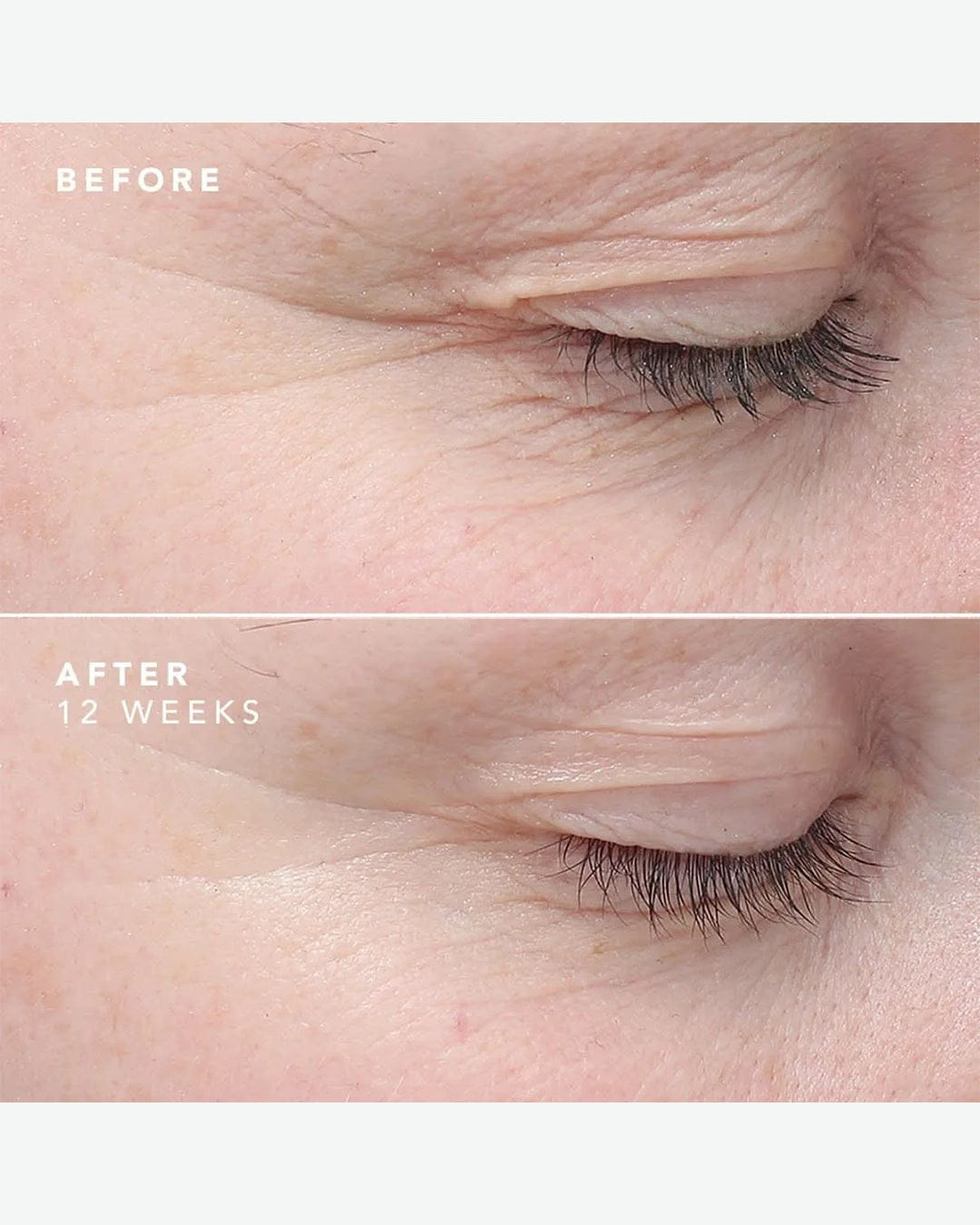 Bioeffect Egf Eye Serum