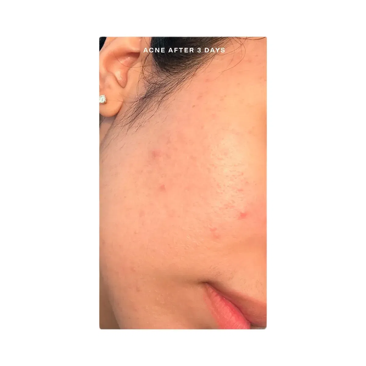 Tower 28 SOS Skincare Minis Kit