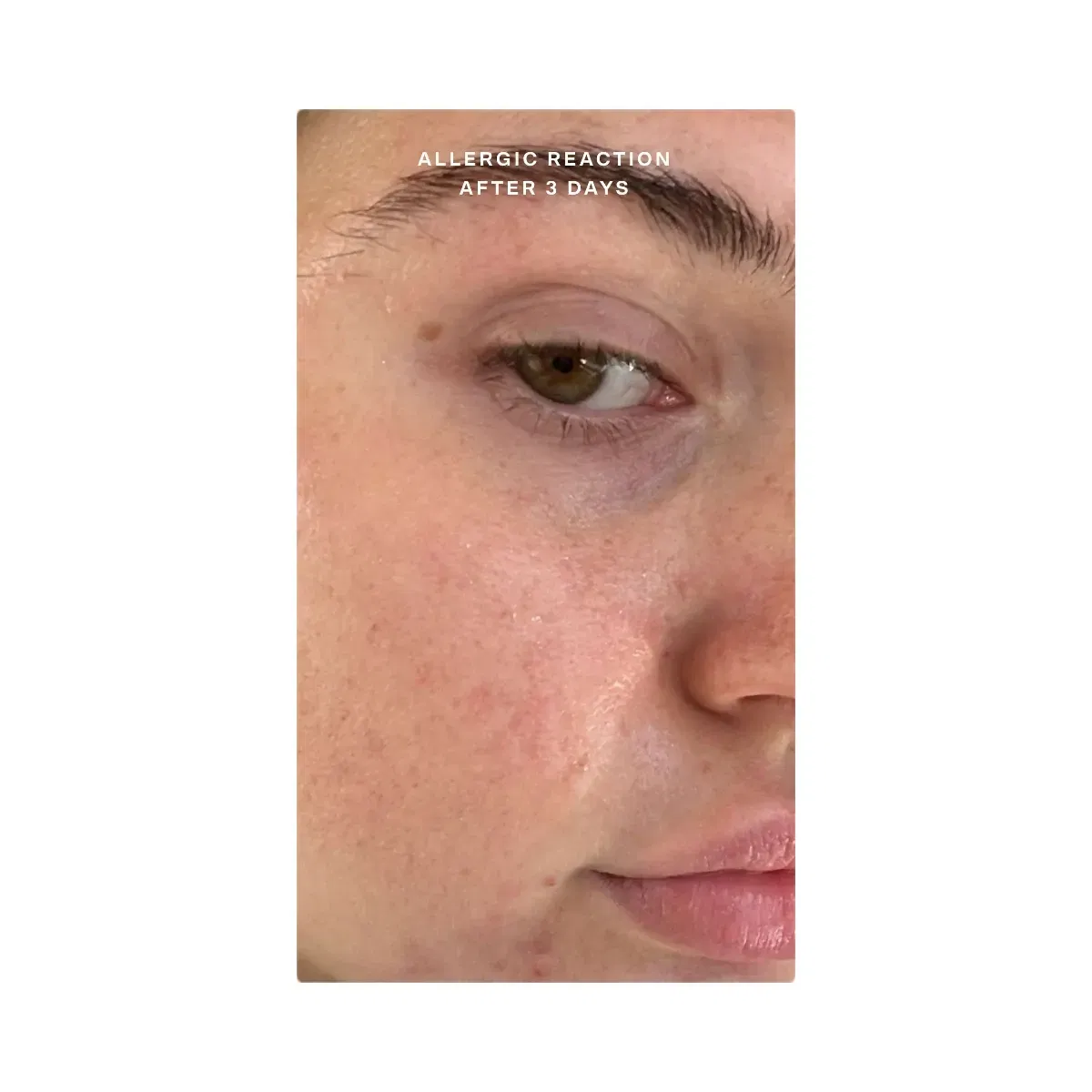 Tower 28 SOS Skincare Minis Kit