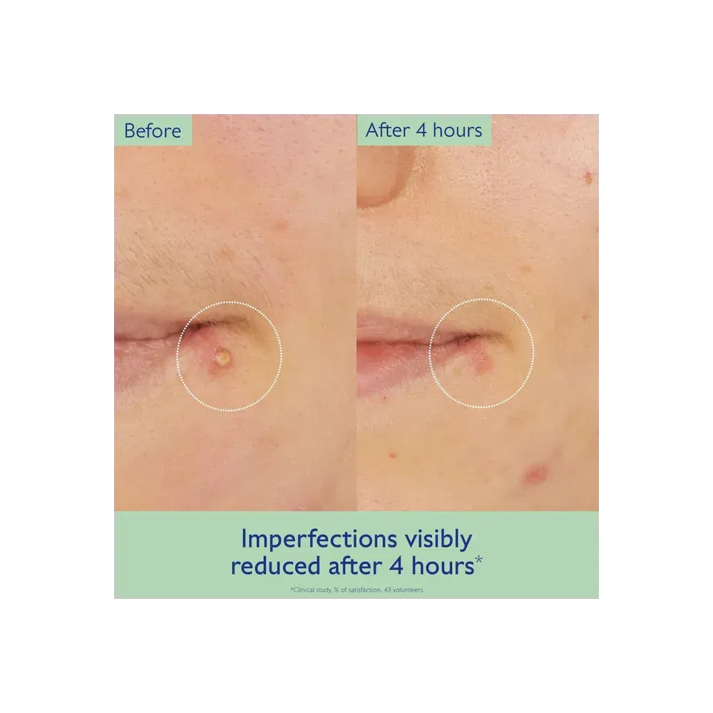 Caudalie Vinopure Targeted Spot Solution With Salicylic Acid