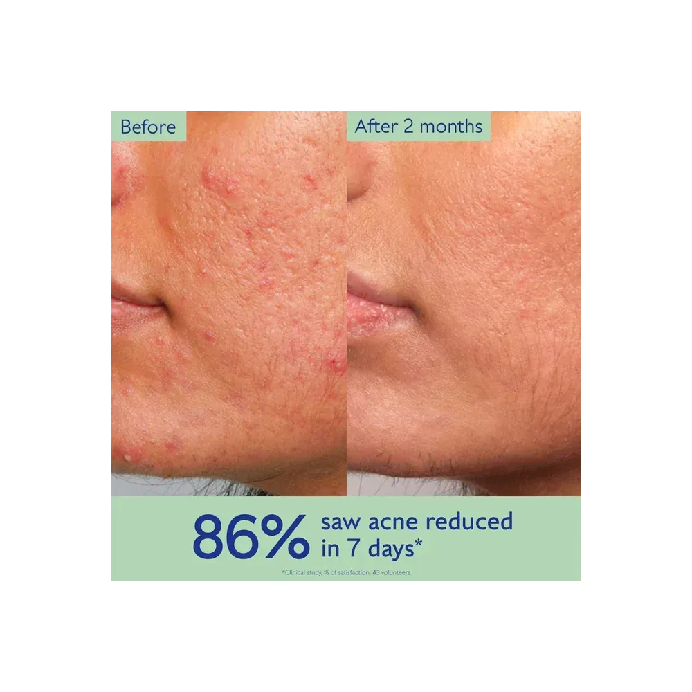 Caudalie Vinopure Acne-Prone Skin Essentials